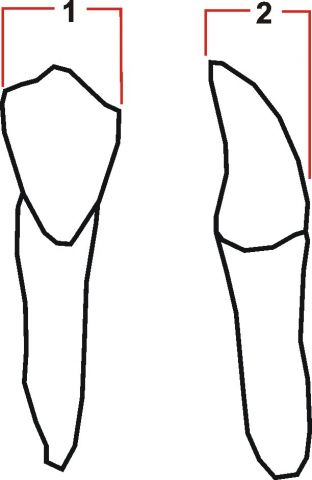 *